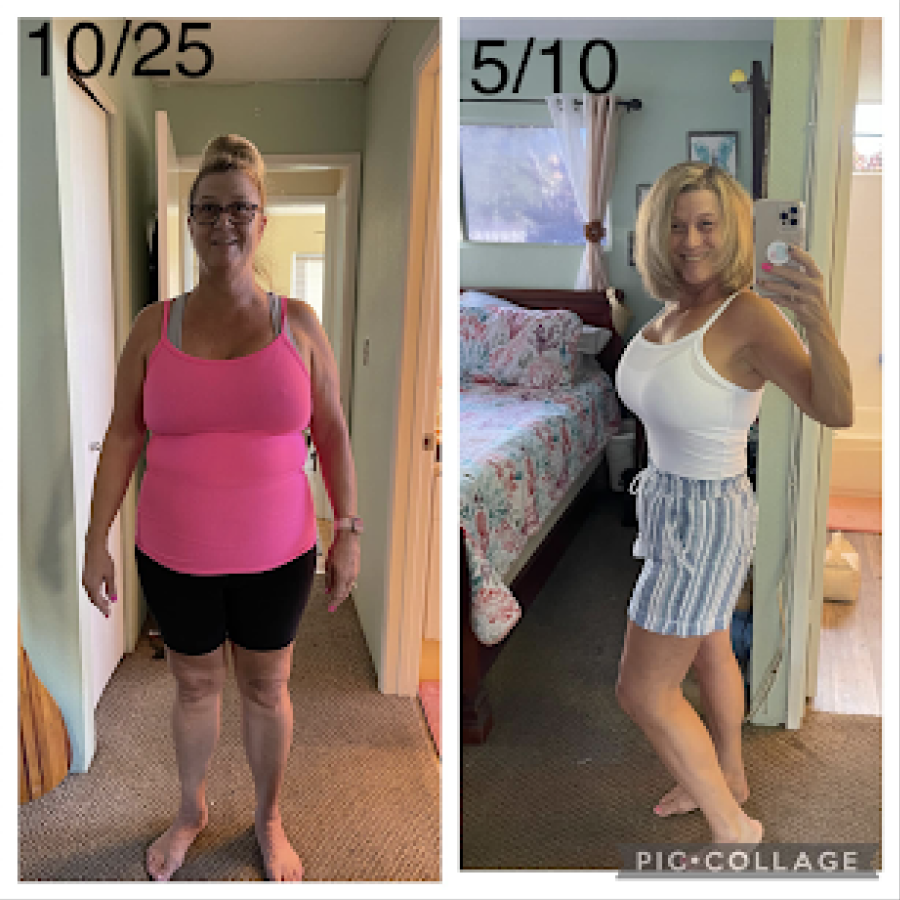 Jennifer W - V Shred Before and After